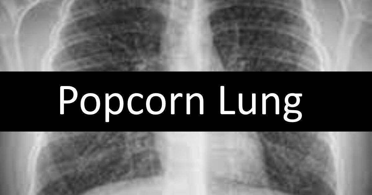 Popcorn Lung What You Need To Know
